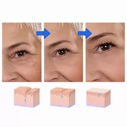 Серум за лице с ботокс Botox Stock Solution