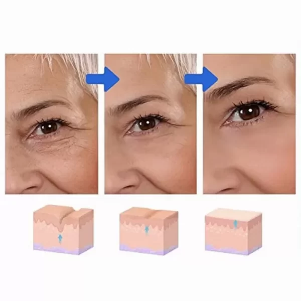 Серум за лице с ботокс Botox Stock Solution