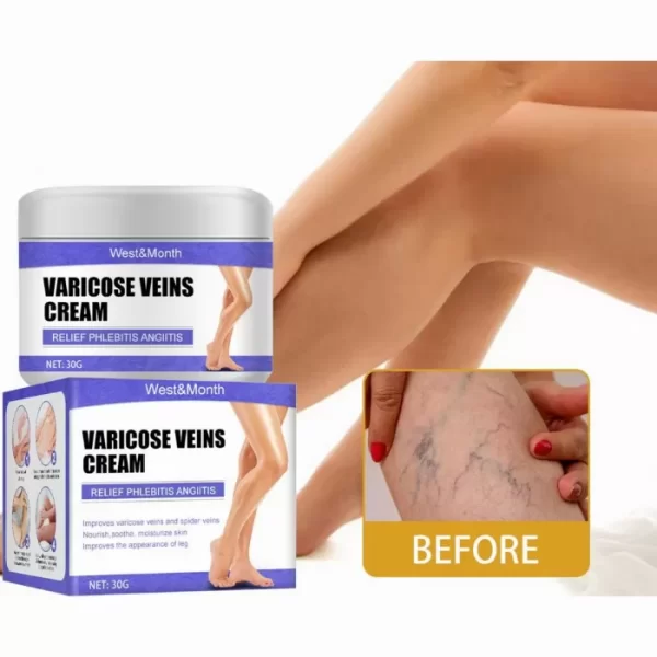 Veins Cream крем за разширени вени и профилактика